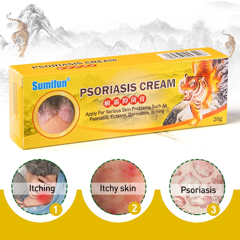 psoriasis cream salep eczema dermatitis itchi