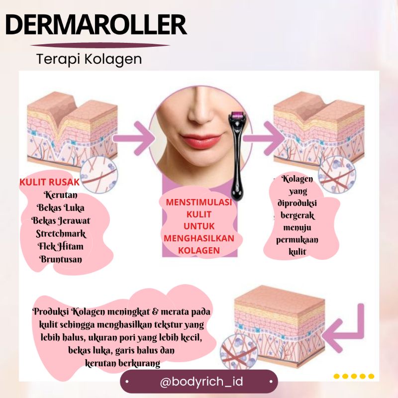 Dermaroller Strechmark Penghilang Bekas Luka Derma Roller Paket Bopeng