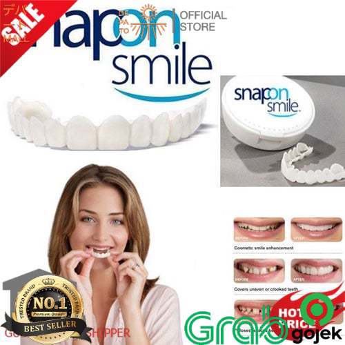 Snap On Smile 100% ORIGINAL Authentic / Gigi Palsu Snapon Smile 1 Set