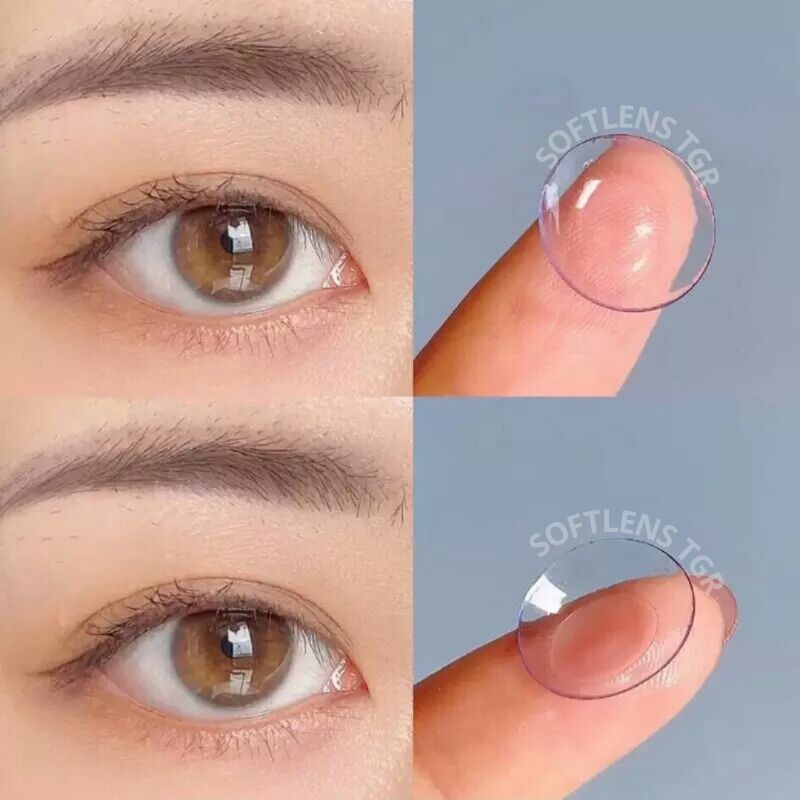SOFTLENS TGR - CLEAR / NORMAL SD -15.00 / SOFTLENS CLEAR / SOFTLENS BENING / SOFTLENS POLOS / SOFTLE
