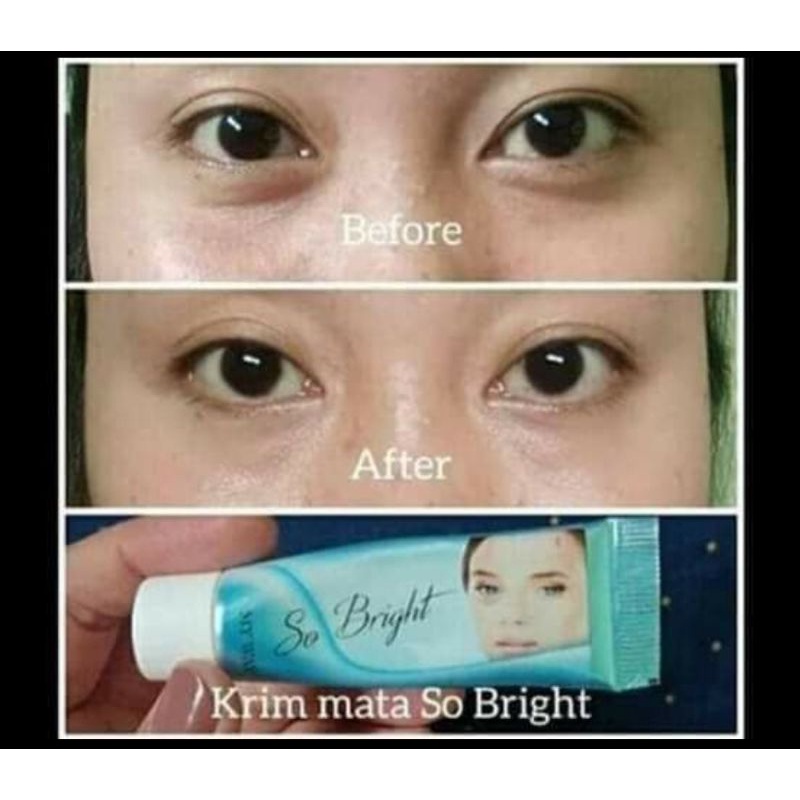 MY WAY SO BRIGHT obat eye cream penghilang kantung mata atau mata panda original // SO BRIGHT face wash  // SO Bright face mask My way