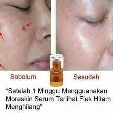 Moreskin Serum Whitening Gold Serum Pemutih Wajah dan Pencerah Wajah