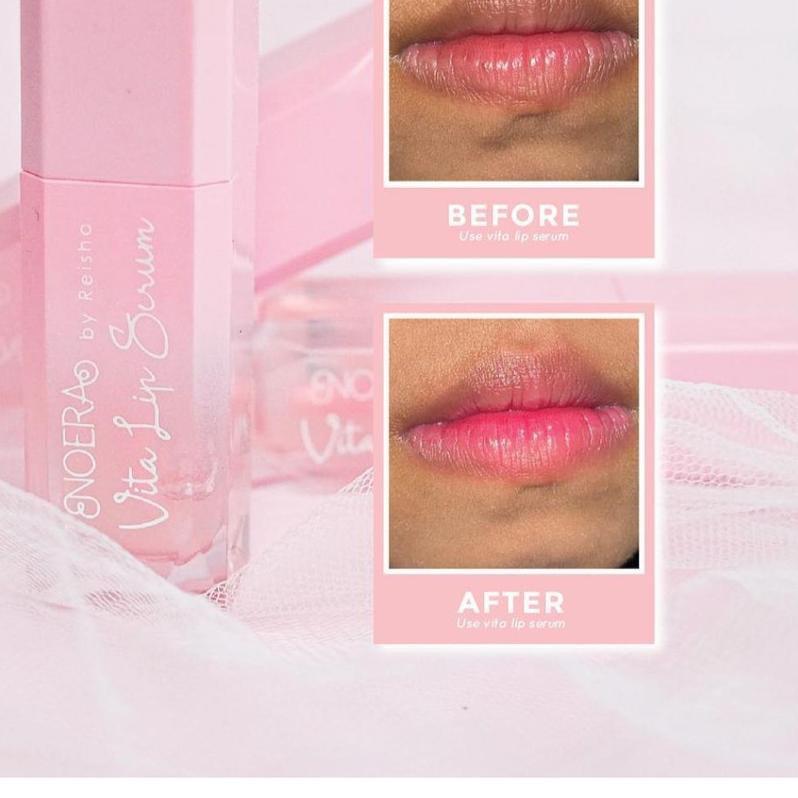 ► [BUY 1 GET 1 GIFT] READY SIAP KIRIM NOERA VITA LIP SERUM GEL noera Lip Gel Noeraskincare ➭