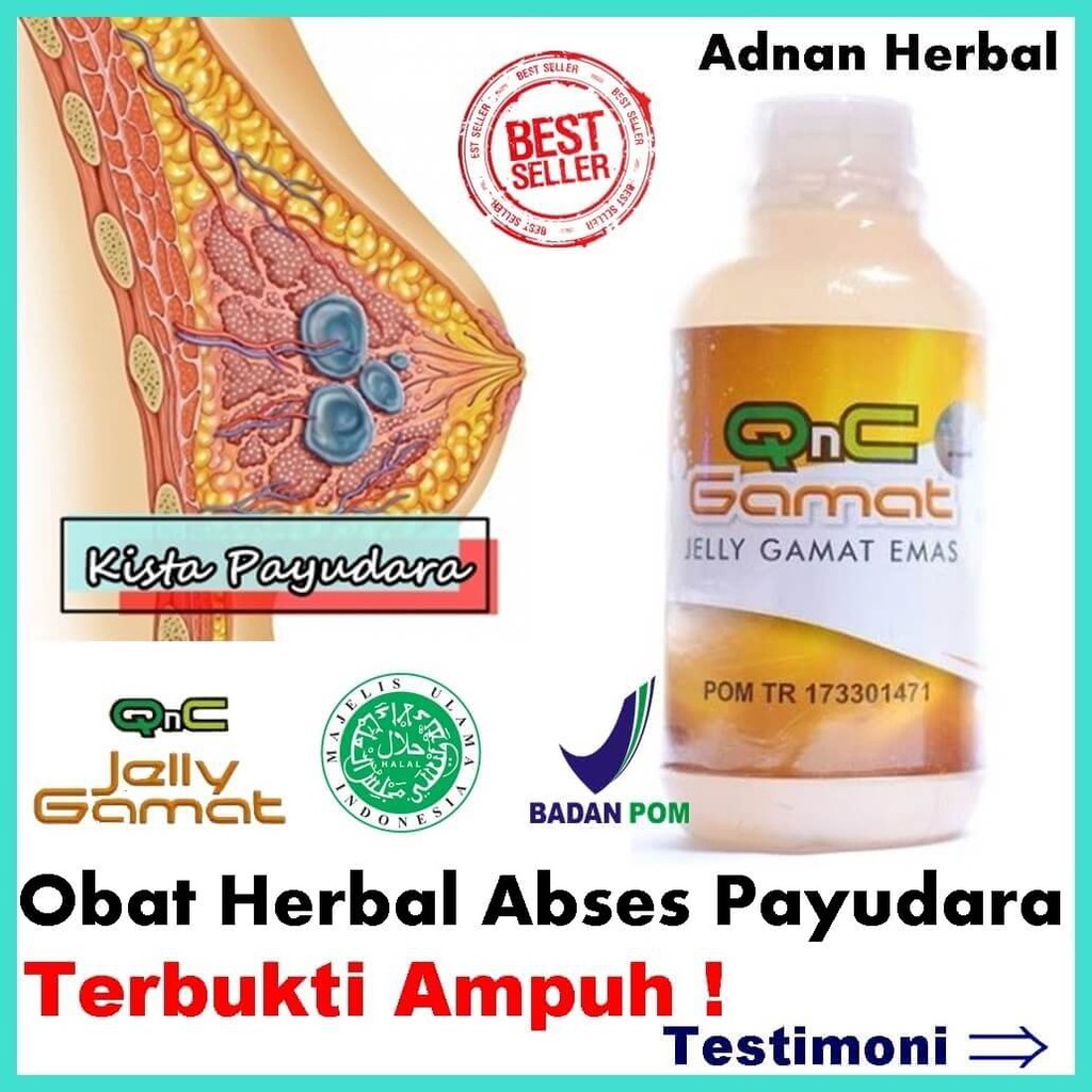 Obat Herbal Abses Payudara | 100% Alami