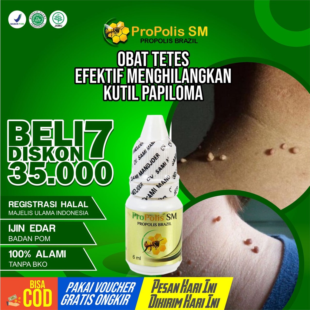 Obat Kutil Papiloma Kutil Kelamin Kutil Tangan Kutil Leher Penghilang Kutil Obat Kutil Propolis SM