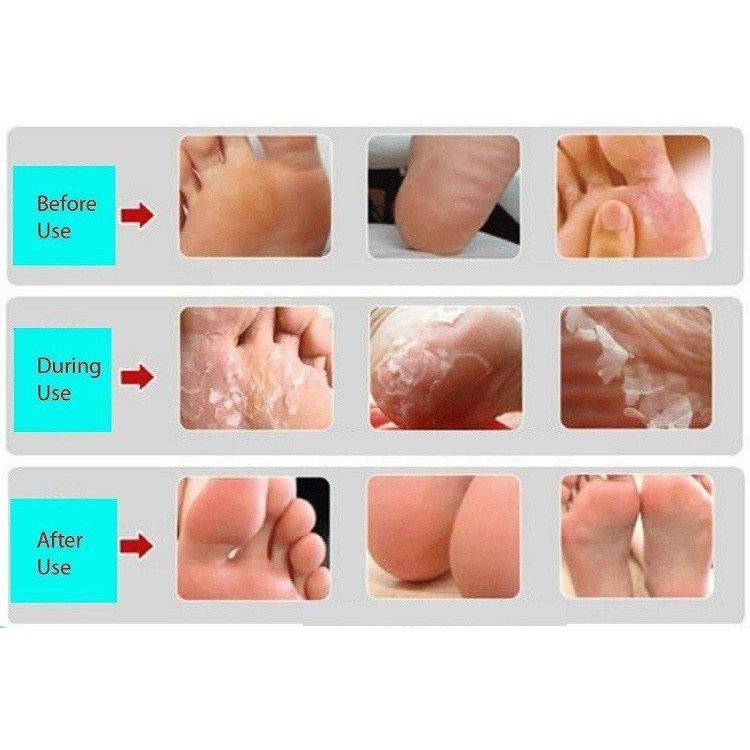 Baby Foot Easy Pack Masker Kaki EXP:July 2024