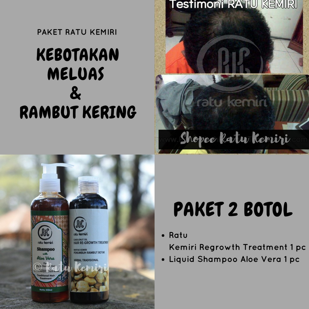 Minyak Kemiri Bakar Ratu Kemiri Obat Penumbuh Rambut Rontok BONUS