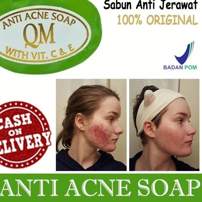 (BISA COD) ORIGINAL 100%  - SABUN QM HIJAU ANTI ACNE - SABUN ANTI JERAWAT - MENGHILANGKAN JERAWAT - KOMEDO