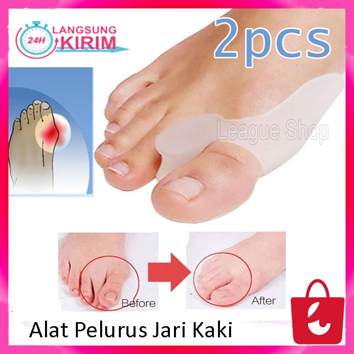 Alat Pelurus Jari Kaki Bengkok Separator Pelindung Perata Perawatan Ibu Jari Kaki Hallux Valgus