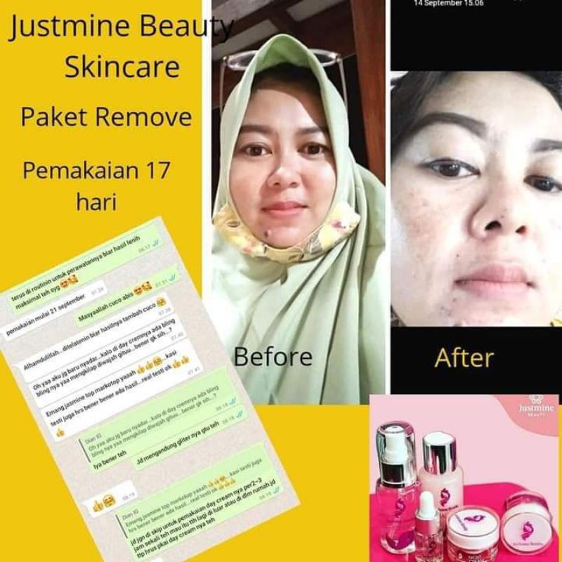 Justmine Beauty Skincare Original paket Remove/Acne More/Ultima Bpom Mengatasi Jerawat, Flek Hitam dan Kulit Sensitiif-8