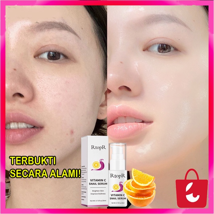 [100% Asli] RtopR Vitamin C Serum Snail Anti Aging Serum Wajah Kontrol Minyak Esensi Pelembab Pemutih Pengecil Pori-pori Anti Penuaan Serum Vitamin C Asam Hyaluronik