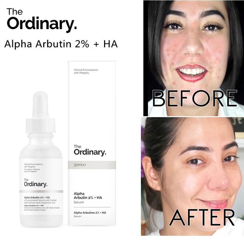 The Ordinary Alpha Arbutin 2% + HA 30ml