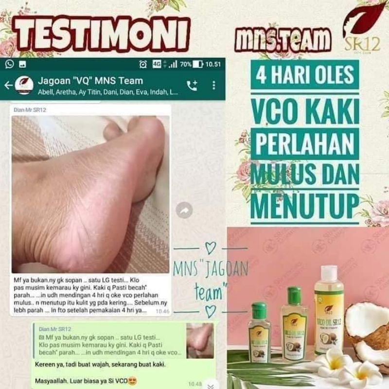 Obat Kaki Pecah dan Kering - Penghalus Tumit Kaki - Minyak Kaki Pecah2 Ampuh