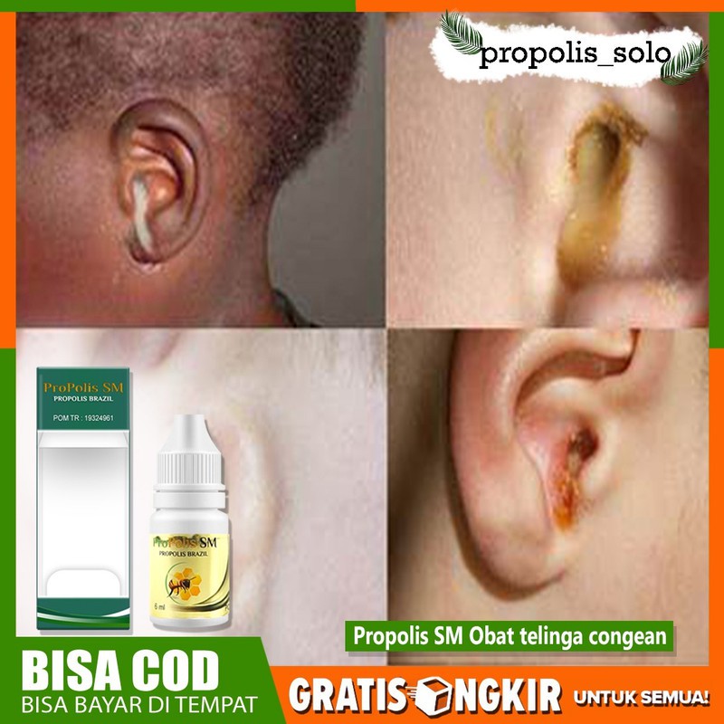 Obat Tuli Sebelah - Telinga Congean - Obat Telinga Mati Sebelah - Propolis Sm Brazil