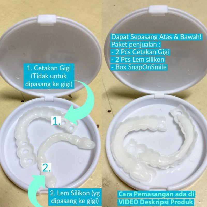 Snap On Smile Gigi Palsu 1 Set Atas Bawah - Gigi Palsu Silikon