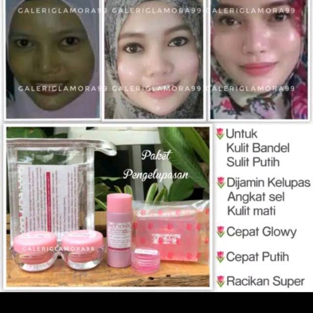 Paket Kelupas / Cream Glowing