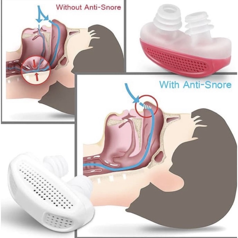ANTI SNORING DEVICE ALAT ANTI NGOROK DENGKUR MENDENGKUR. (AMPUH) ANTI SNORE DENGKUR - 2 IN 1