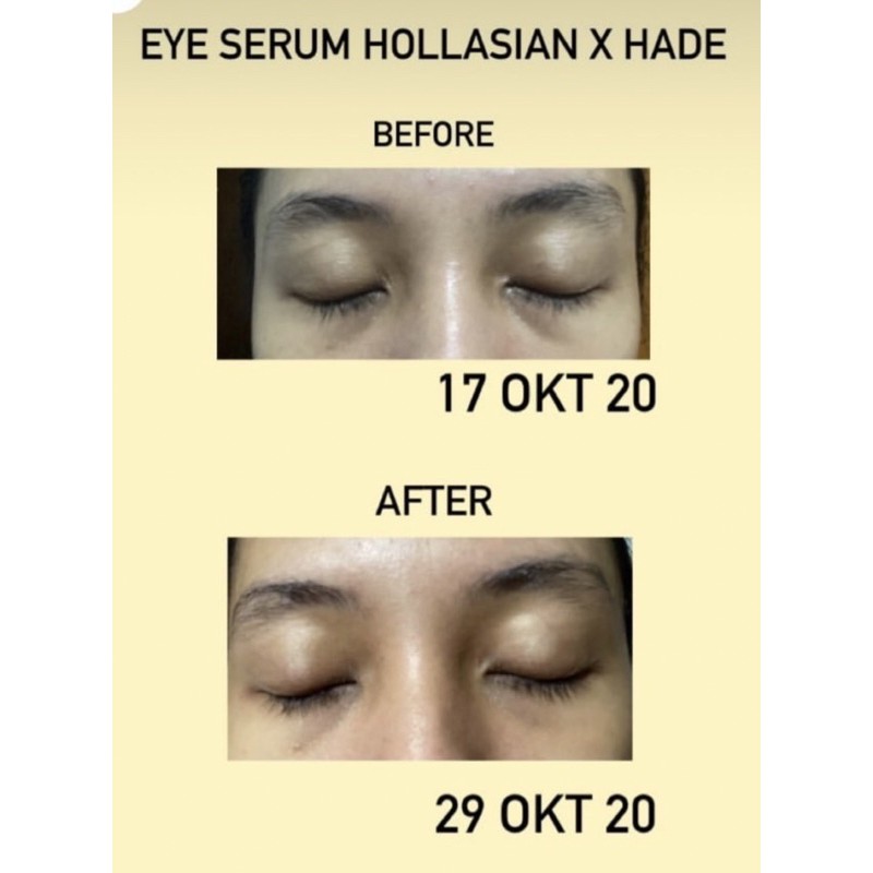 PINEAPPLE EYE FIRMER SERUM HOLLASIAN X HELLODERMA EYE SERUM PENGHILANG MATA PANDA DAN KANTUNG MATA