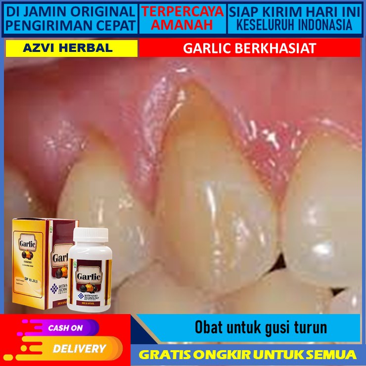 obat gusi turun  Obat Alami Untuk Gusi Turun Obat Alami Untuk Gusi Turun, Gusi Bengkak, Gusi Berdara