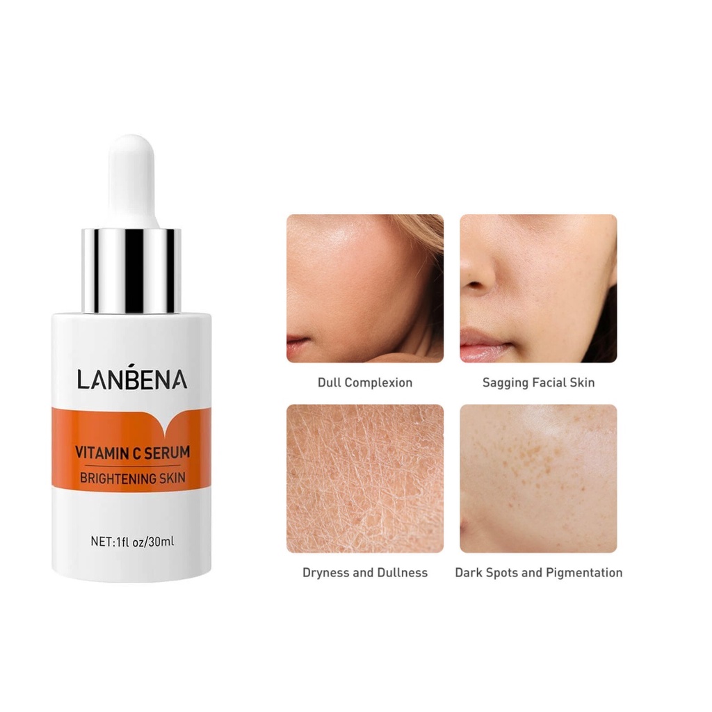 [BPOM] LANBENA Serum [ Vitamin C | Hyaluronic Acid | Acne ]