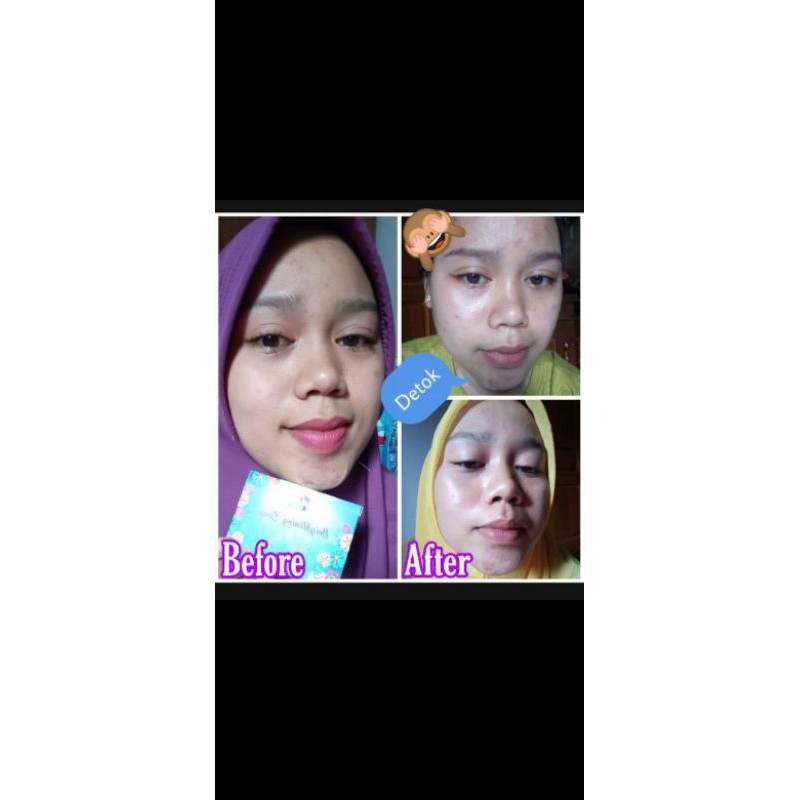 SABUN KEDAS BEAUTY ORIGINAL