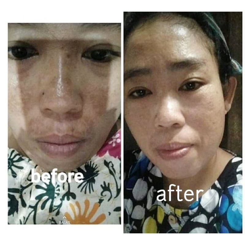 TSAMAANIYA Skincare Bpom Perawatan Wajah PAKET ALLSKIN TYPE 15gr-3