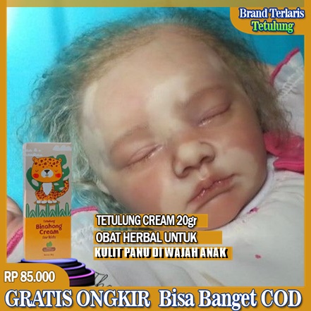 Obat Panu Di Wajah Anak Menghilangkan Panu Di Punggung Dada Leher Pipi Tangan Obat Jamur Kulit Palin