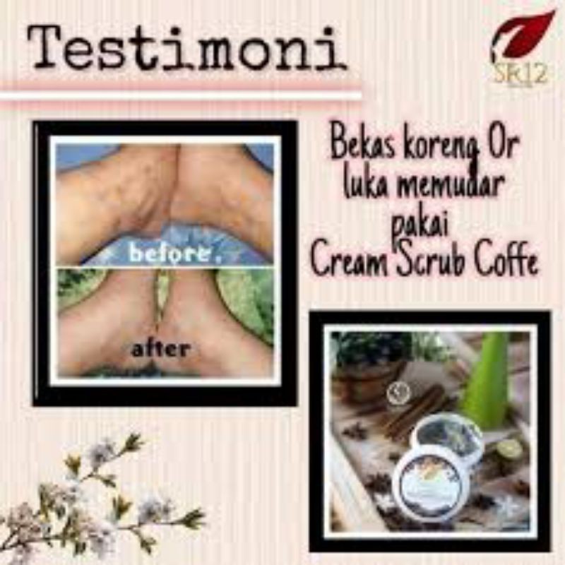 LULUR KOPI VIRAL//PERONTOK DAKI//MENGATASI LEHER HITAM//LIPATAN PAHA HITAM