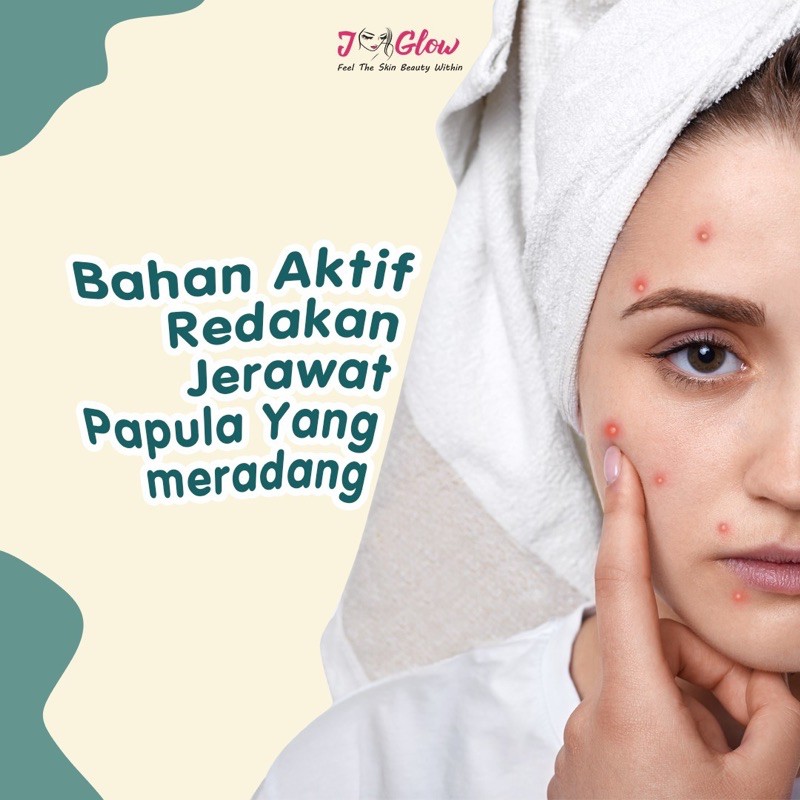 JGLOW SKINCARE EXTRA ACNE PERAWATAN MUKA JERAWAT 5pc