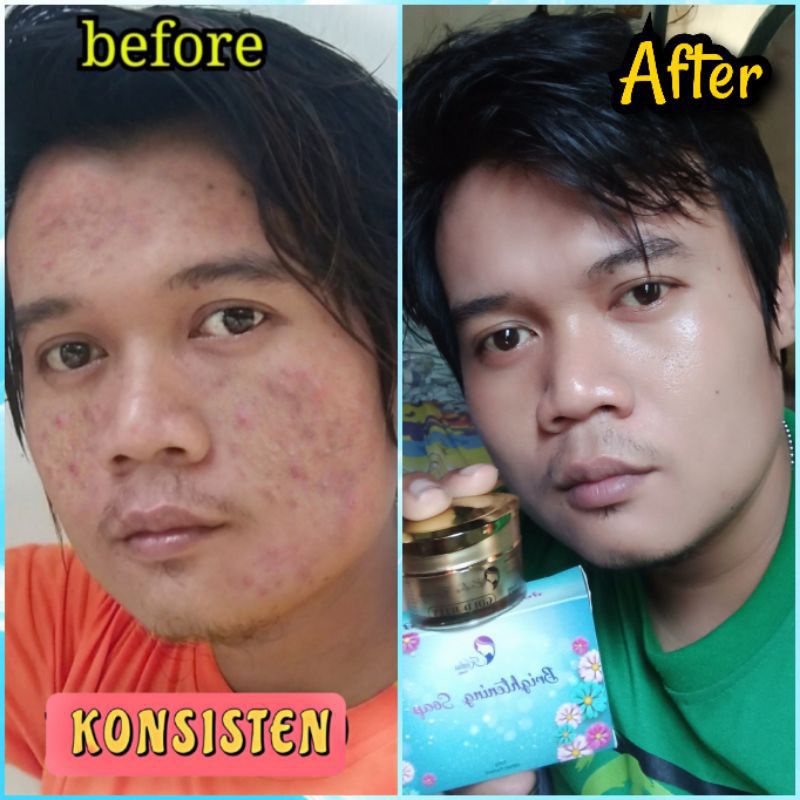 Gold jelly kedasbeauty original (kemasan baru) / GOLDJELLY KEDASBEAUTY Free SOUVENIR-5