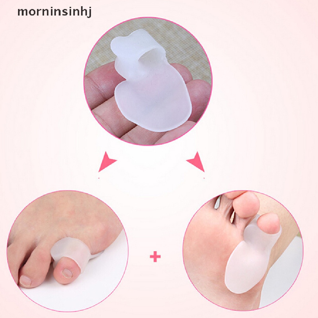 1 Pasang Separator Jari Kaki Orthotics