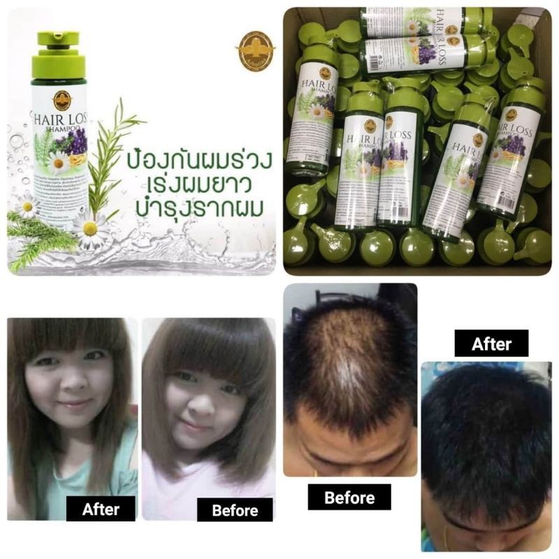 ARBUTINA SHAMPOO HAIR LOSS