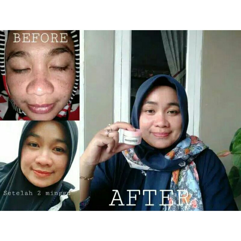 SR GLOW PLATINUM100%ORI ,TIDAK ORI UANG100%KEMBALI