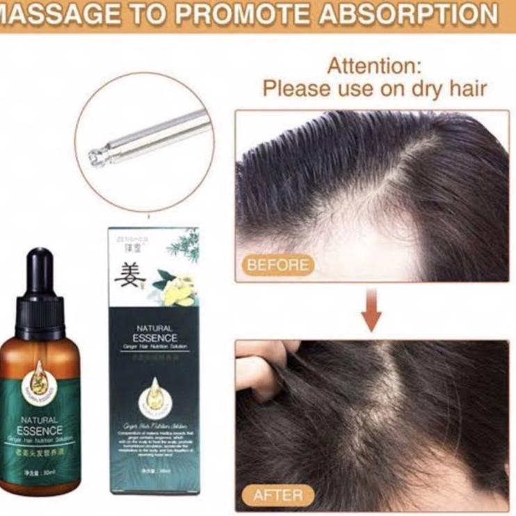 SERUM PENUMBUH RAMBUT BOTAK PENUMBUH BREWOK PENUMBUH ALIS CEPAT