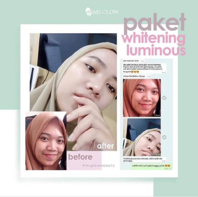 MS GLOW Paket Whitening Luminous (untuk menyamarkan noda hitam )