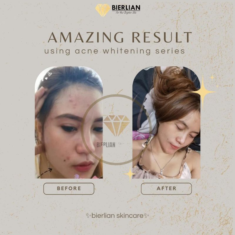 [BPOM] BIERLIAN CREAM WAJAH WHITE GLOW/SUPER WHITE/ACNE/FLEK [Free Pouch/Totebag]-4