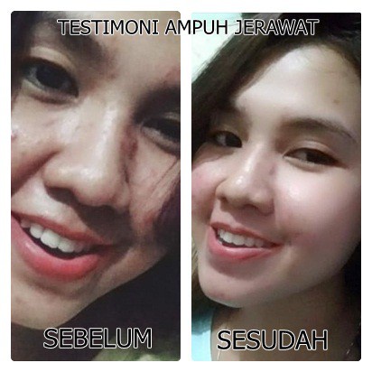 TLF beauty water 100 ml ( dulu bernama TF miracle water)