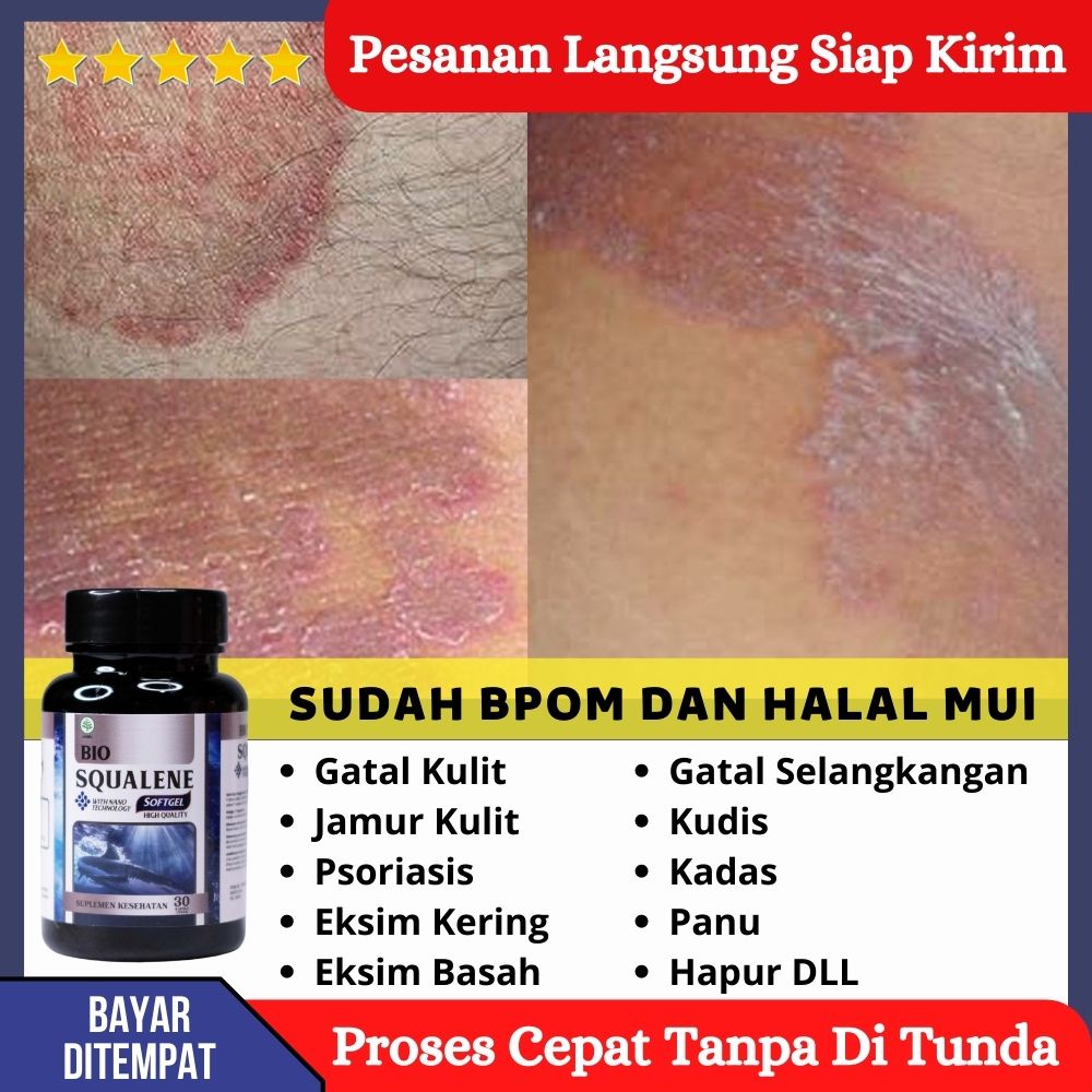 Jual Bio Squalene 30 Softgel 100 Asli Original Tanpa Efek Samping Obat