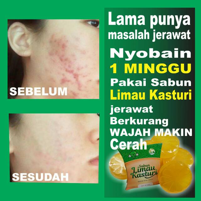 SABUN LIMAU KASTURI (SALIKA) ORIGINAL 100%