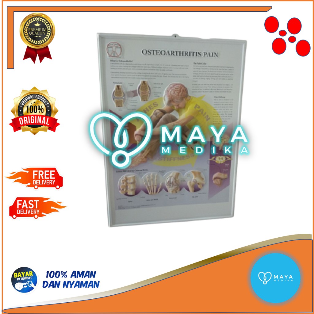 Gambar 3D / Osteoarthritis Pain