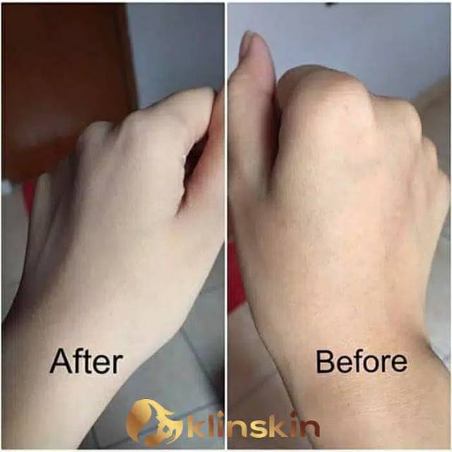 SABUN KEDAS/SABUN KLINSKIN/GOLD JELLY KEDAS ORI-5