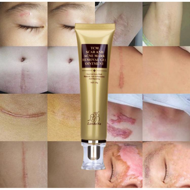 KELOID  /  PORE PENGHILANG PORI PORI / 24k gold / KELOID / STRECTMARK - BREYLEE COLLAGEN  COLLAGEN ANTI PENUAAN ORI