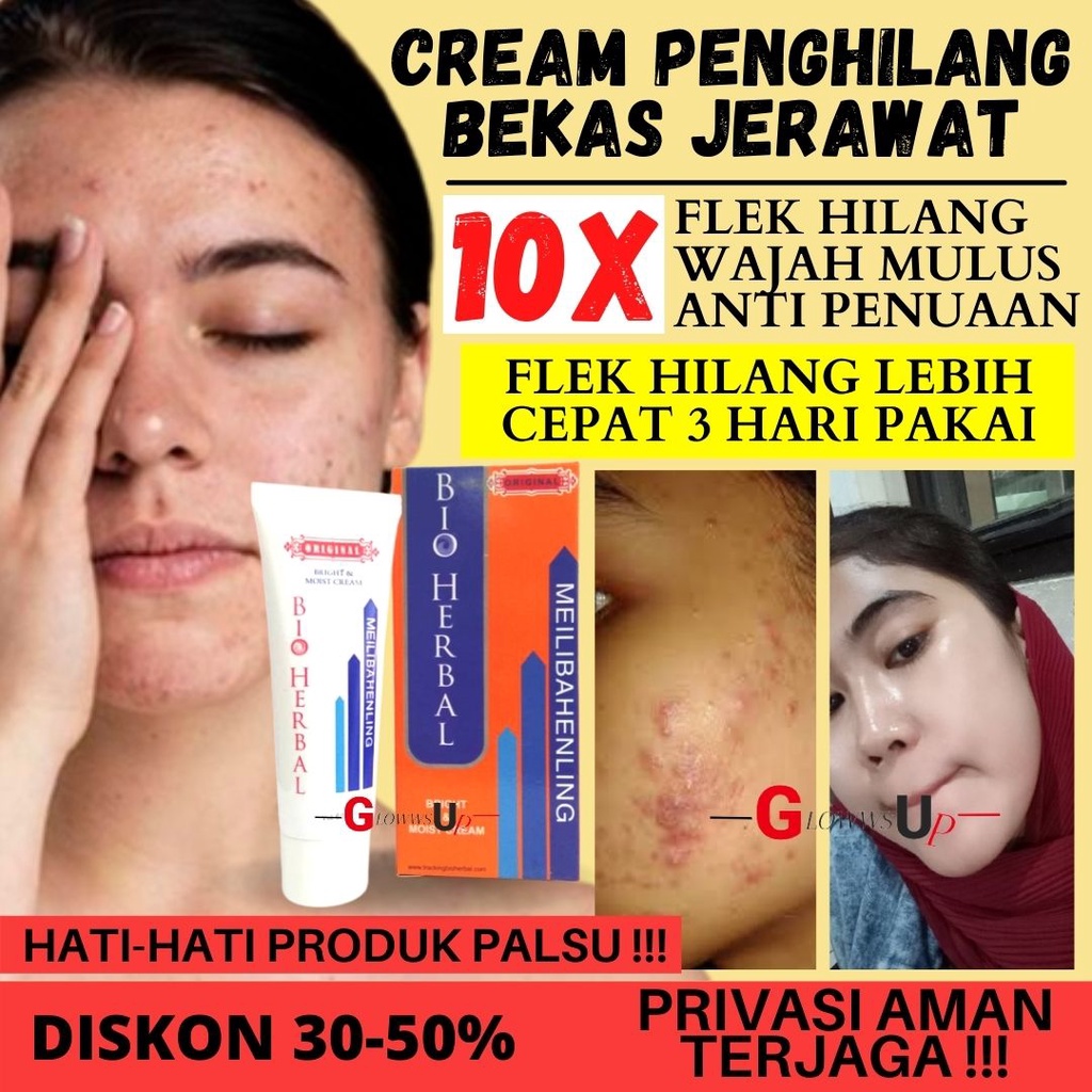 PENGHILANG BEKAS LUKA BIO HERBAL MEILBAHENLING ORIGINAL BPOM CREAM LUKA PERAWATAN TUBUH