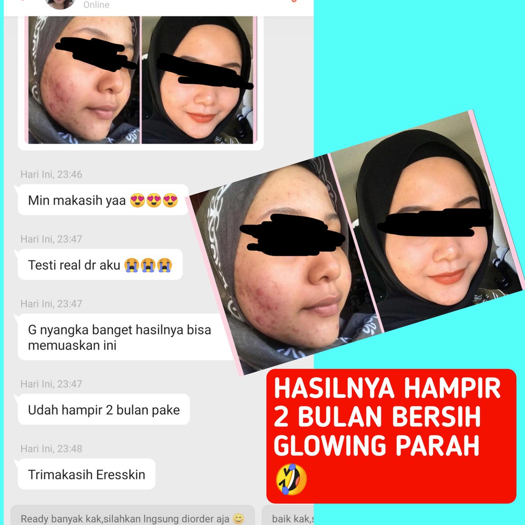 [ORIGINAL] GLOW SERUM WAJAH WHITENING PEMUTIH MUKA/FACE ACNE / DARK SPOT /BRIGHTENING ORI BPOM HALAL