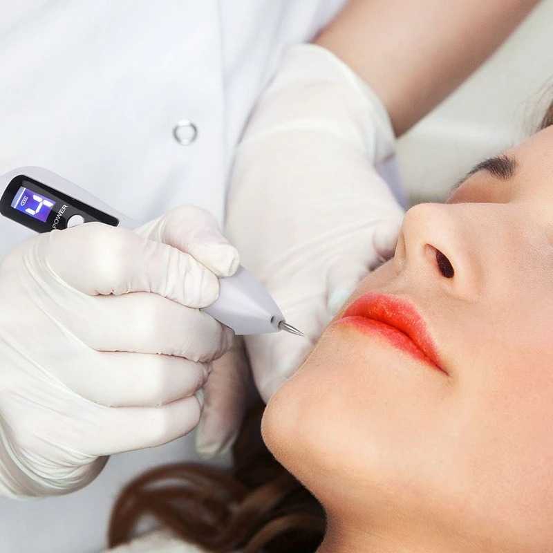 Laser Pembunuh Bakteri Pen Laser Plasma Penghilang Jerawat Dark Spot Wajah Iebilif - JT75