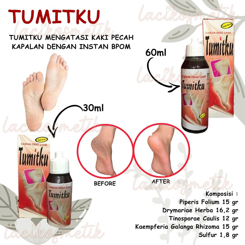 ✨LACIKOSME✨ TUMITKU MENGATASI KAKI PECAH - KAPALAN DENGAN INSTAN BPOM