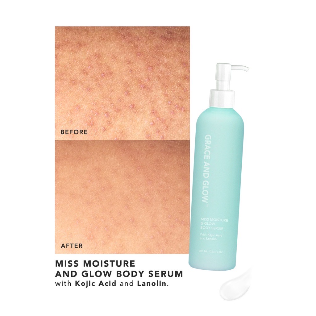 GRACE AND GLOW Miss Moisture &amp; Glow Solution Body Serum 300ml