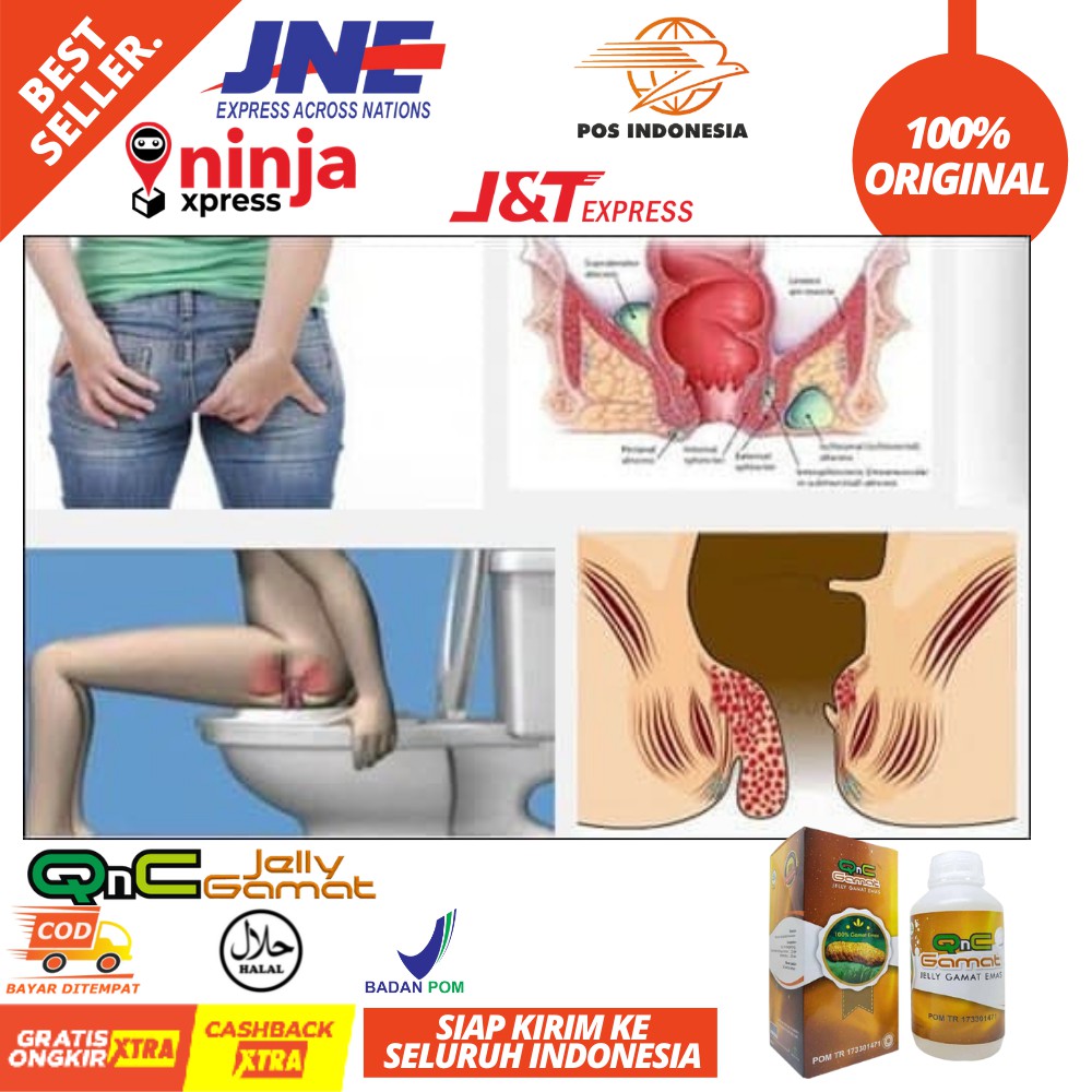 Obat Ambeien / Wasir / Obat Ambeien Anus Keluar Berdarah / Ambeien Luar / Dalam - QnC Jelly Gamat