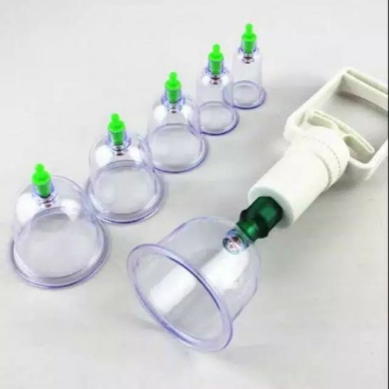 (COD) Alat bekam set / kop angin / Alat terapi bekam set 6 tabung