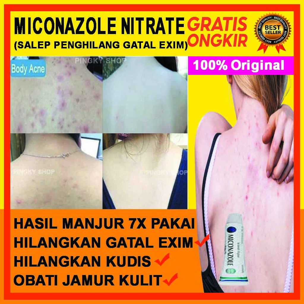 Obat Infeksi Jamur - Salep Gatal - Obat Gatal - Salep Penghilang Panu - Salep Penghilang Gatal Selan